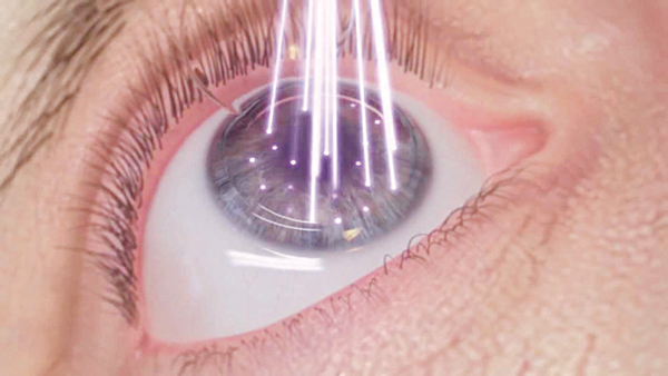 Bổ mắt sáng mắt Eye Diamond là giải pháp Thế hệ mới